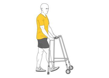 Ejercicio fisioterapia prótesis de rodilla